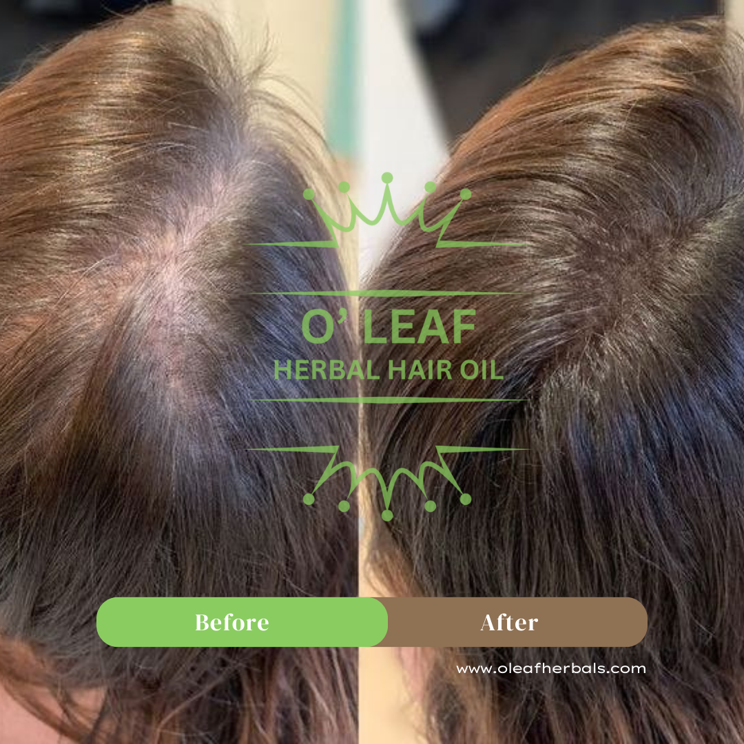 O'LEAF Herbal Hair Oil For Dry Damaged Hair Men And Women